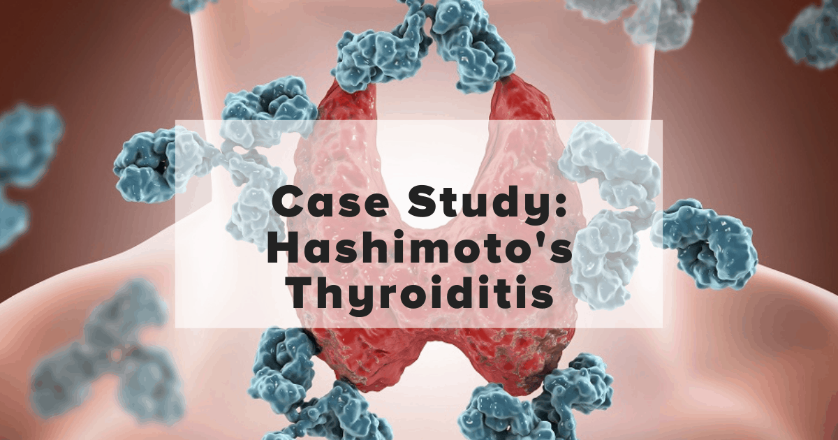 Case Study: Hashimoto’s Thyroiditis